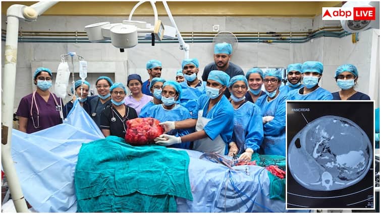 सफदरजंग के डॉक्टरों ने किया चमत्कार, 19 साल की लड़की के पेट से निकाला 10 किलो का ट्यूमर