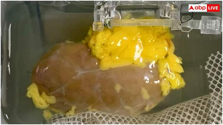 Universal Kidney: अब नहीं रुकेगा किसी भी ब्लड ग्रुप के मरीज का किडनी ट्रांसप्लांट, वैज्ञानिकों ने बना ली यूनिवर्सल किडनी