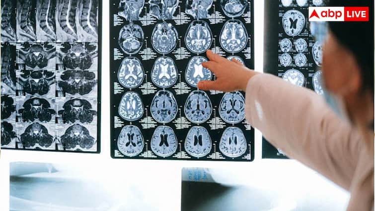 सिर में सिर्फ दर्द है या ब्रेन ट्यूमर ने कर ली एंट्री? इन वॉर्निंग सिग्नल से पता लगती है असली प्रॉब्लम