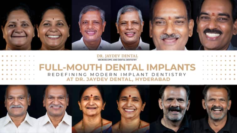 Full-Mouth Dental Implants in One Day — Dr. Jaydev Dental, Clears the Myths Around Modern Implant Dentistry