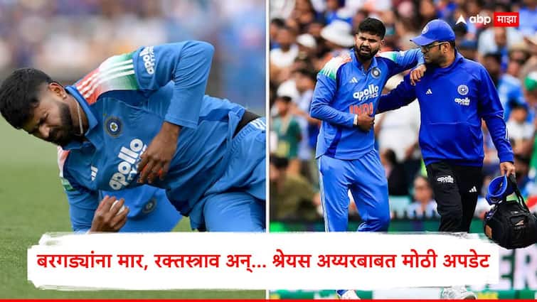 Shreyas Iyer News : बरगड्यांना मार, रक्तस्त्राव, पण सिडनीत झाली नाही सर्जरी; श्रेयस अय्यरबाबत BCCI ने दिली माहिती, कशी आहे तब्येत?