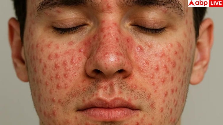 Who gets Baltod First: बाल तोड़ किन लोगों को होता है जल्दी, हमारे शरीर के लिए यह कितना खतरनाक?